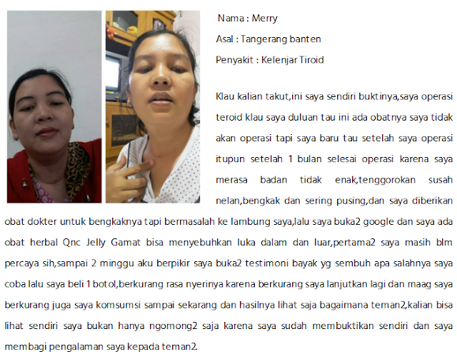 Obat Gondok Beracun yg TERBUKTI MUJARAB Menyembuhkan Gondok Beracun Sampai Sembuh Total Obat Gondok Beracun yg TERBUKTI MUJARAB Menyembuhkan Gondok Beracun Sampai Sembuh Total