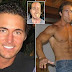 This Handsome Man Who Lost Half His Face To Cancerous Tumour Gets Terminator-Style Transplant Built By Genius Surgeon