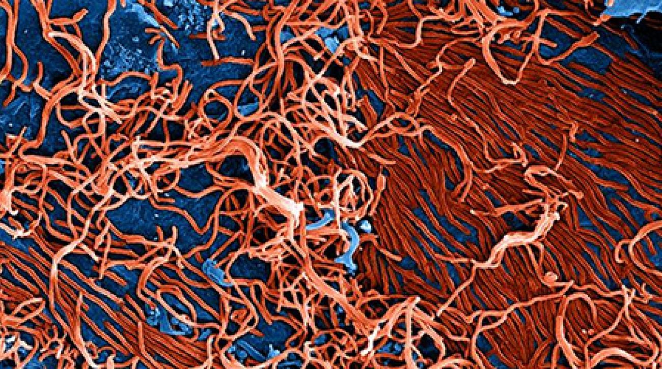 Hale Plus Hearty Marburg virus disease