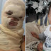 Bebê tem rosto desfigurado por água fervente e pais fazem apelo na internet