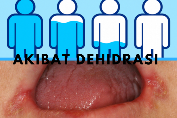 Jangan Anggap Remeh, ini Bahayanya Jika Rasa Haus Kamu Berlebihan