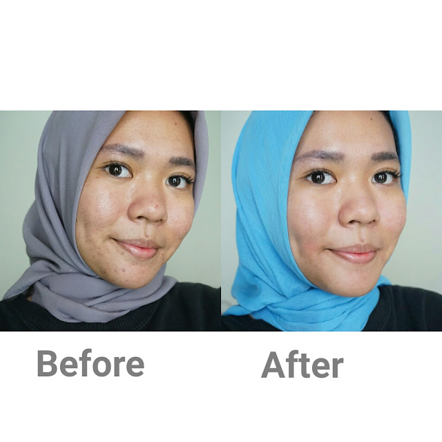 testimoni loreal white perfect