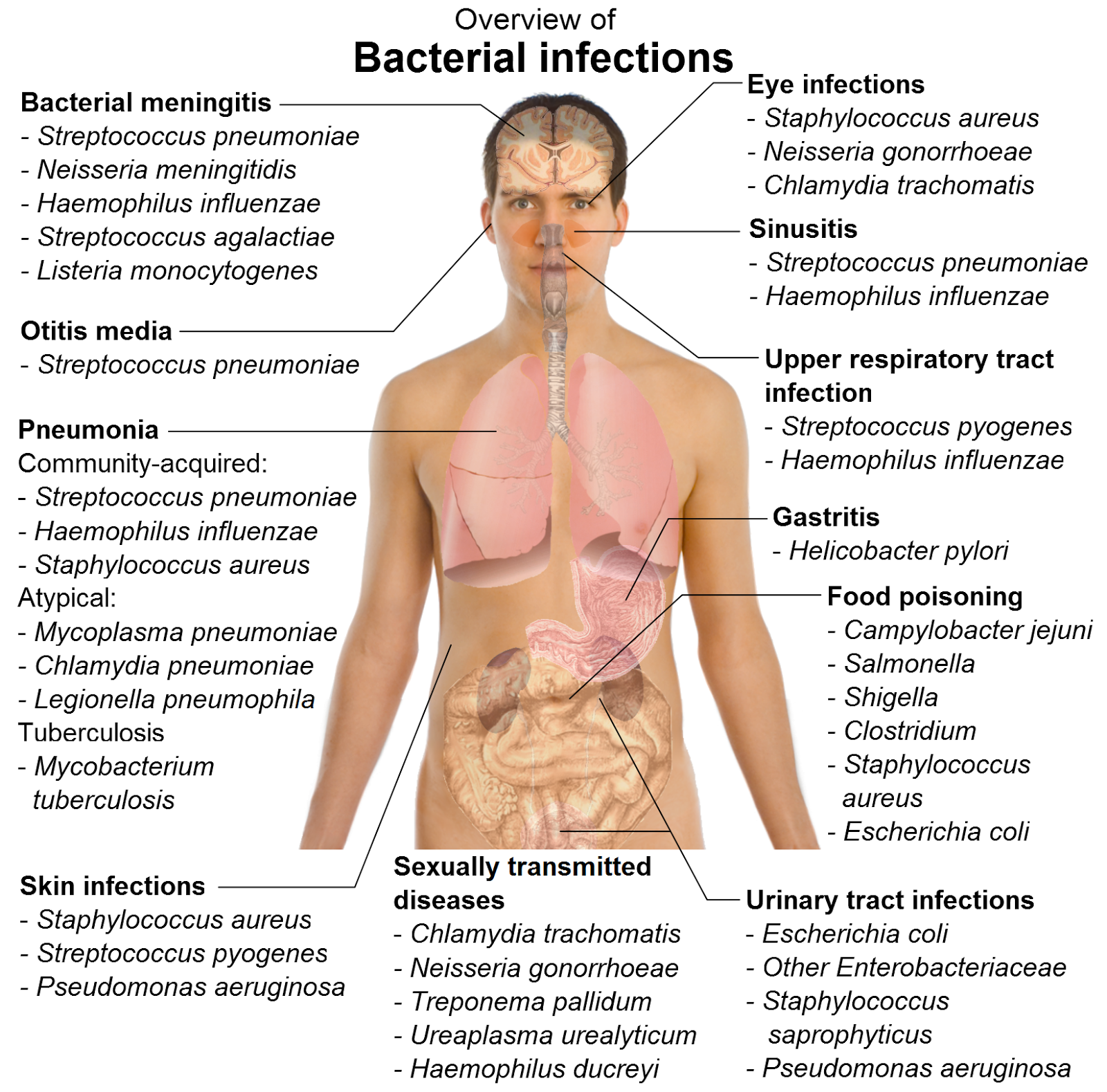 what cause bacterial infections