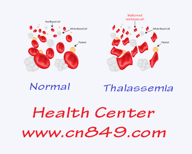 thalassemia anaemia