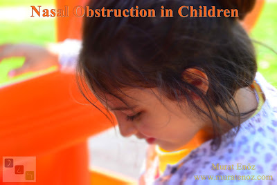​Nasal Obstruction in The Pediatric Patients - Functions of the Nose - Causes of Nasal Obstruction - Diagnosis of Causes of Nasal Obstruction and Different Symptoms - Diagnosis of Causes of Nasal Obstruction and Different Symptoms - Nasal Obstruction Due to Upper Respiratory Tract Infections - Treatment of Nasal Obstruction in Children and Infants - Why Nasal Obstruction Occurs in Babies More Easily? - Adenoidectomy in İstanbul - Adenoidectomy in Turkey