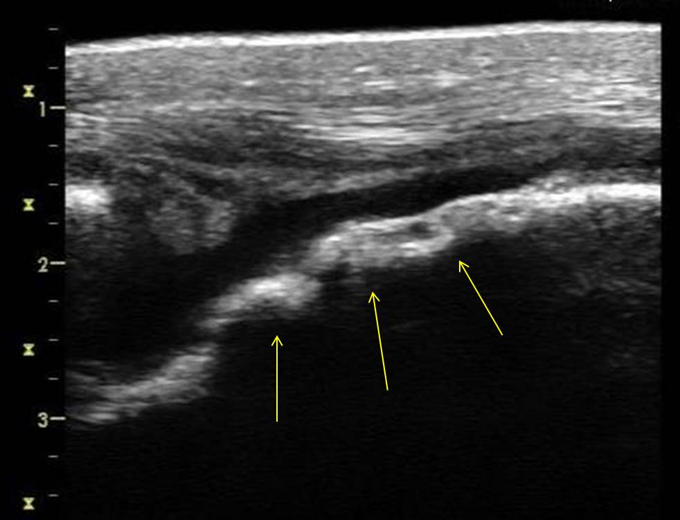 Michael Porter, Equine Veterinarian Stifle OCD!!