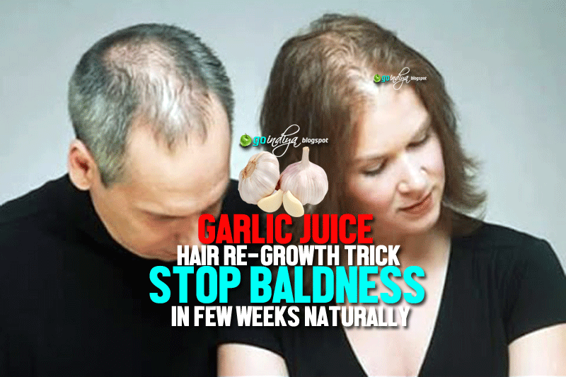 Losing Hair? Stop Baldness with Garlic Juice. Hair Regrowth Trick