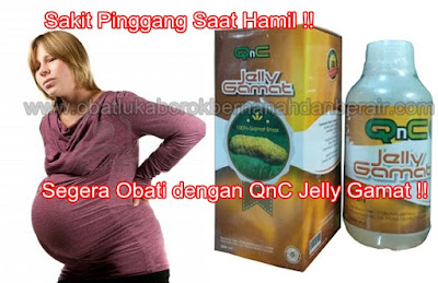Obat Sakit Pinggang Saat Hamil yg Manjur, Alami & Tanpa Efek Samping Obat Sakit Pinggang Saat Hamil yg Manjur, Alami & Tanpa Efek Samping