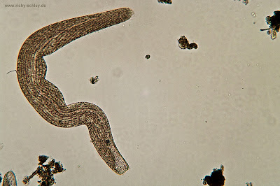 Trichinella Worm