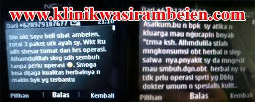 obat wasir ampuh di apotik