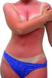 A primeira regra para um bronzeado perfeito A primeira regra para um bronzeado perfeito,Pele, Sol, Bronzeado, Cuidados,Proteção da pele na exposição solar,
