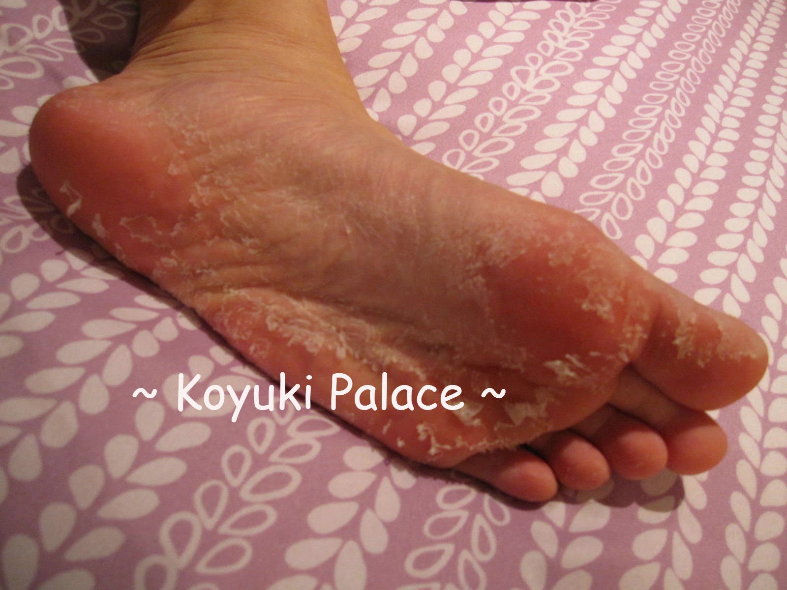 Koyuki Palace - Korean Cosmetics: Baby Foot