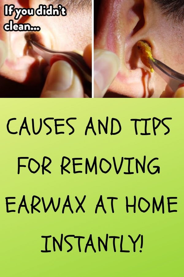 CAUSES AND TIPS FOR REMOVING EARWAX AT HOME INSTANTLY!