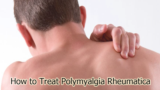 How to Treat Polymyalgia Rheumatica