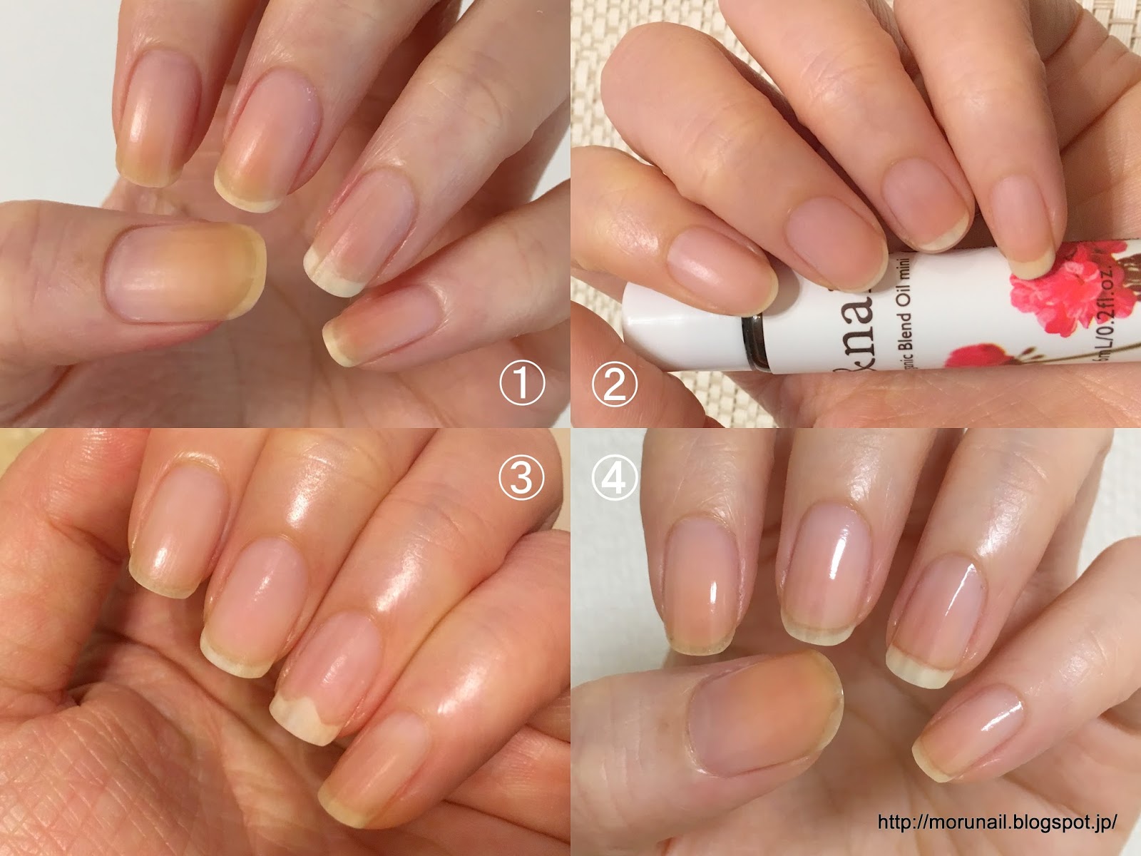 Moru's nails （実証）やっぱり爪を伸ばしたほうがネイルベッドも伸びる