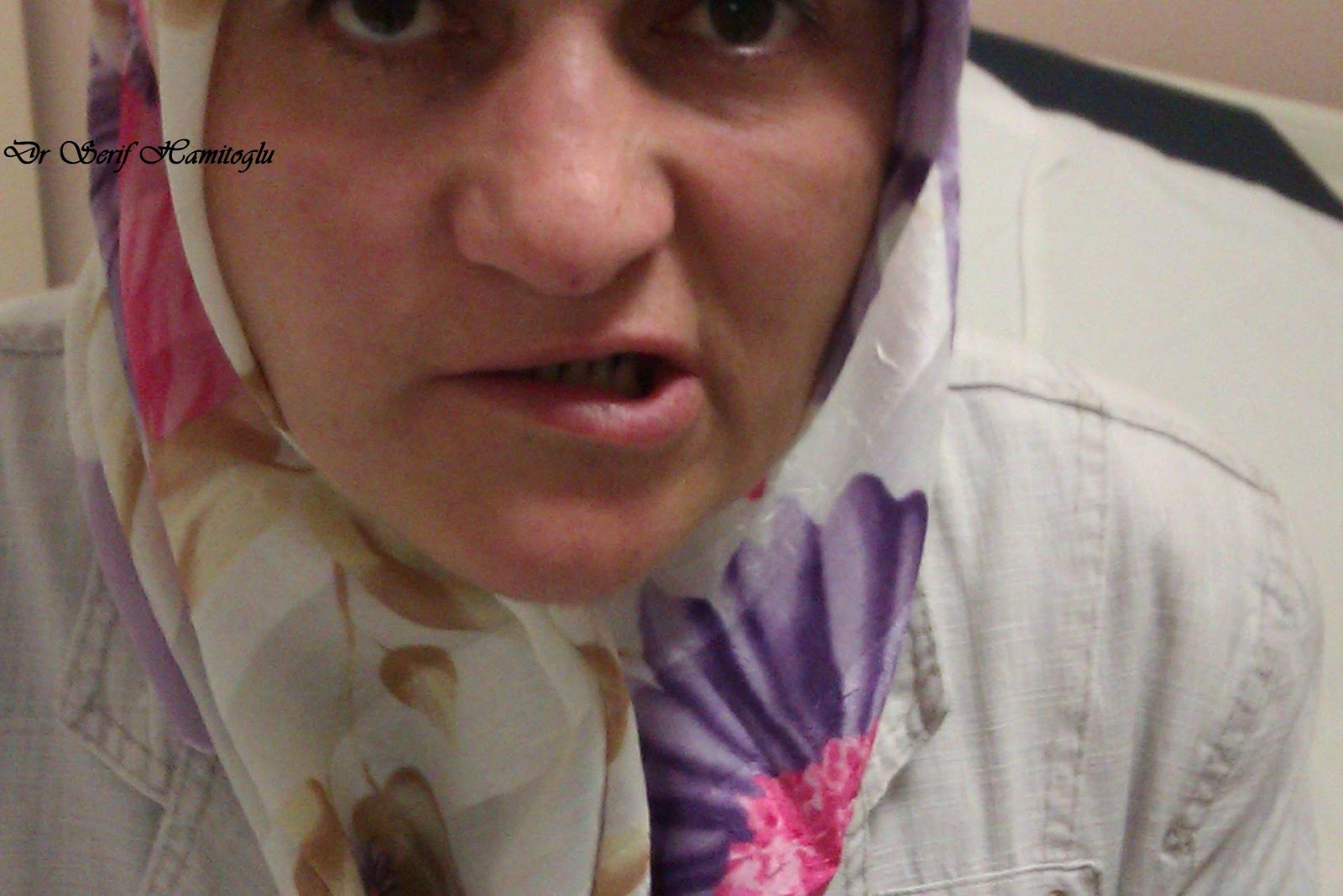 facial nerve palsy emedicine Grabbing your dick before ejaculate