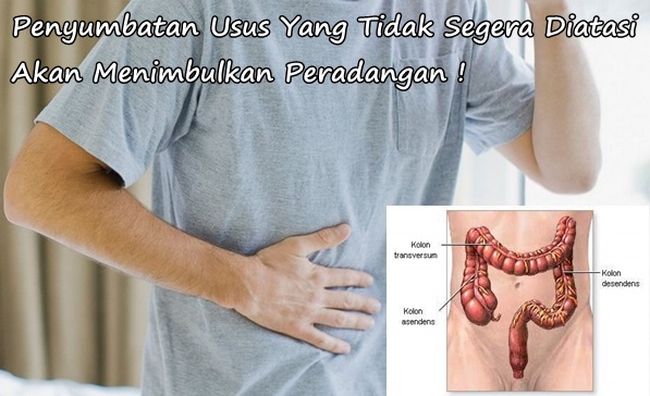 Pengobatan Herbal Penyumbatan Usus Paling Cepat Sembuh Pengobatan Herbal Penyumbatan Usus Paling Cepat Sembuh