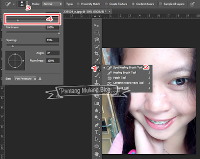 Cara Menghilangkan Jerawat Menggunakan Photoshop Cara Menghilangkan Jerawat Menggunakan Photoshop