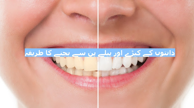 Danton Ko Keera Khatm, Dant Safaid - دانتوں کے کیڑے اور پیلے پن سے بچنے کا طریقہ Danton ka peela pan khatm, danton ka pila pan khatm karne ka totka, danton ko safaid krne ka tariqa, daant safaid banane ka totka, daant mazboot banane ka tariqa, danton ka desi ilaj, best totka for teeth care, danton ka keera khatm karne ka tariqa