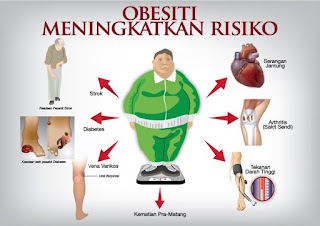 Obesitas Obesitas