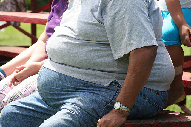 Médicos americanos declaram que a obesidade é uma doença