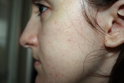 beautypul, adapalene, adapaleno, aging, anti age, envejecimiento, mi experiencia, retinal, retinol, retinyl palmitate, tretinoin, tretinoina, vitamina A, 