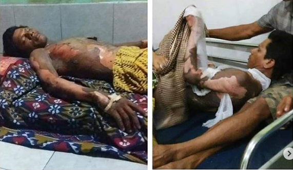 Istri Tega Bakar Suami Karena Tidak Diberi Tahu Sandi Ponsel, Faktanya Suami Sudah Main...