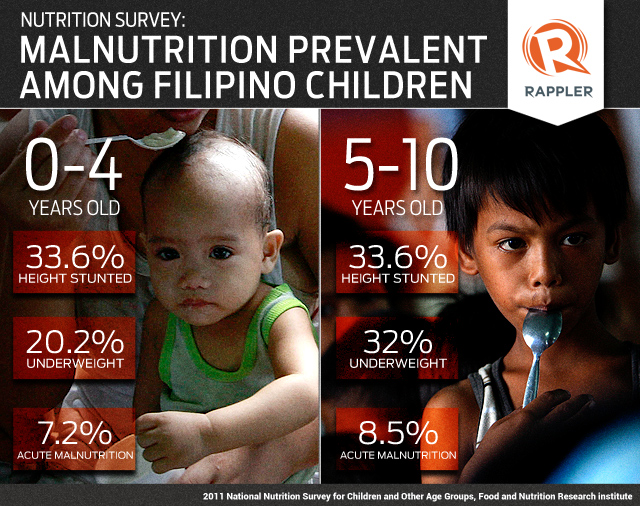 Philippines Malnutrition 2024 Ailee Jerrilee