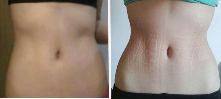 Pratica tl corset Clearance