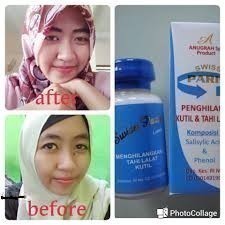 Agen Resmi Jual Swiss Paris Lotion Penghilang Tahi Lalat di Surabaya, Jawa Timur