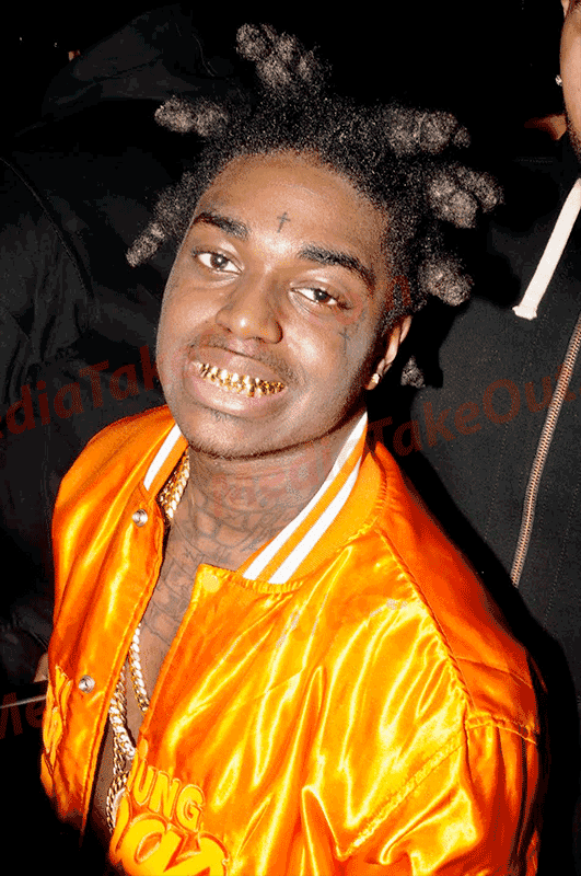 Rapper KODAK BLACK Got A Special 32 TOOTH GRILL . . . Even His BACK