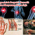 Patofisiologi gout arthritis (ASAM URAT)