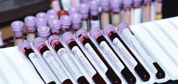 اهم التحاليل الدورية الشاملة للجسم