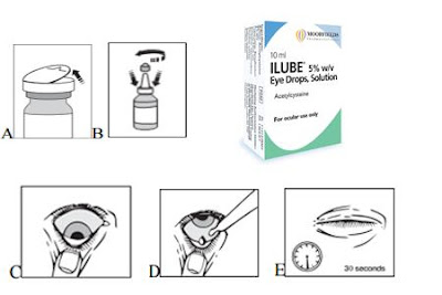 Ilube 5%w/v Eye Drops dosing, how to take Ilube