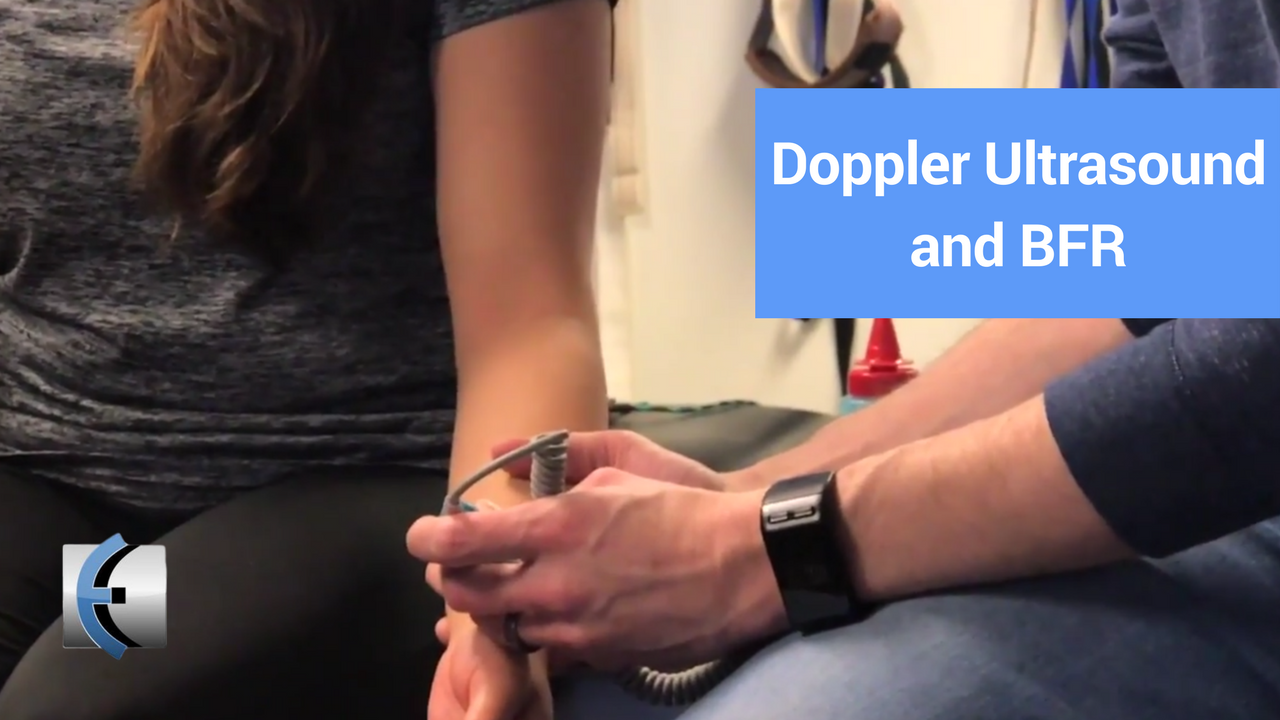 doppler ultrasound