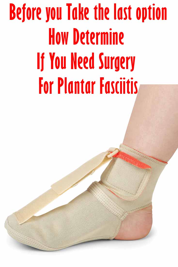 All you need to know plantar faciitis natural treatment