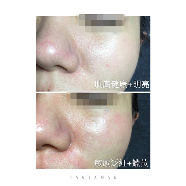 顏之鑽高雄美容做臉清粉刺除痘痘護膚SPA,奎蒂絲杏仁酸精華液, 高雄左營岩盤浴推薦, 高雄全身去角質推薦, 高雄美容沙龍推薦, 高雄美容SPA推薦, 高雄做臉清粉刺推薦, 高雄WAXXXX熱蠟除毛推薦, 顏之鑽高雄美容做臉清粉刺除痘痘護膚SPA,高雄左營美容店,左營美容SPA護膚, 高雄左營做臉,高雄左營做臉推薦,高雄左營做臉分享,高雄左營做臉評價,高雄左營做臉價格, 高雄左營清粉刺,高雄左營清粉刺推薦,高雄左營清粉刺店家,高雄左營清粉刺推薦店家,高雄左營清粉刺價格, 高雄左營清粉刺評價,高雄左營清粉刺分享,高雄左營清粉刺便宜,高雄左營無痛清粉刺,高雄左營擠粉刺, 高雄左營美顏店推薦,高雄左營美顏店家, 高雄左營美容店推薦, 高雄左營熱蠟除毛,高雄左營熱蠟除毛便宜,高雄左營熱蠟除毛分享,高雄左營熱蠟除毛評價,高雄左營熱蠟除毛價格, 高雄左營熱蠟除毛推薦,高雄左營蜜蠟除毛評價,高雄左營蜜蠟除毛便宜,高雄左營蜜蠟除毛價格,高雄左營蜜蠟除毛推薦, 高雄左營腋下除毛評價,高雄左營腋下除毛推薦,高雄左營腋下除毛價格,高雄左營腋下除毛分享,高雄左營腋下除毛便宜, 高雄左營私密處除毛評價,高雄左營私密處除毛推薦,高雄左營私密處除毛價格,高雄左營私密處除毛便宜, 高雄左營岩盤浴SPA,高雄左營岩盤浴,高雄左營岩盤浴推薦,岩盤浴高雄左營