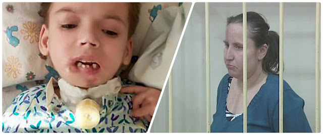 Koszmar. Matka odgryzła swojej 6. letniej córeczce wargę, bo dziewczynka płakała. Rok później dziecko zmarło Koszmar. Matka odgryzła swojej 6. letniej córeczce wargę, bo dziewczynka płakała. Rok później dziecko zmarło