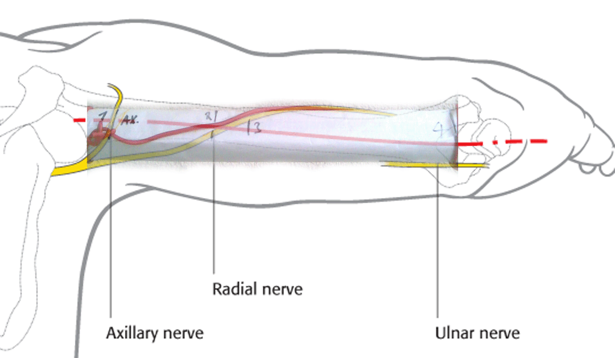 My knots and ties: Radial nerve rotation