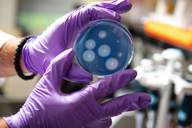 You are what you eat: How the pursuit of carbs changed mammals' genes and saliva You are what you eat: How the pursuit of carbs changed mammals' genes and saliva