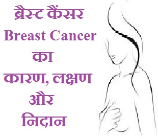 ब्रैस्ट कैंसर / Breast Cancer का कारण, लक्षण और निदान  Nirogikaya  Jiyo Healthy