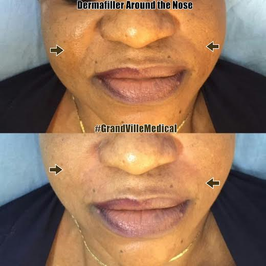 Plastic surgery in Nigeria