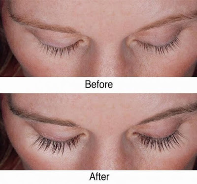 The Best Way to Grow Eyelashes – A DIY Miracle Serum