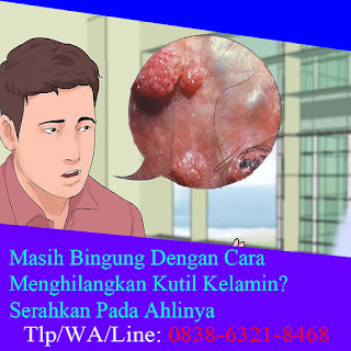 Obat  Kutil Kelamin