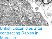 https://sciencythoughts.blogspot.com/2018/11/british-citizen-dies-after-contracting.html