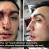 Ohio. Coppia gay picchiata a sangue al grido di «Dio odia i froci. Andrete all'inferno»