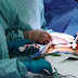 Cáncer de Esófago y Estómago - Prevención, Síntomas y Tratamiento