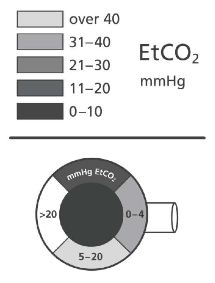 EM Didactic: Capnography beyond ROSC