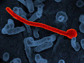 Ebola virus disease, Ebola: Symptoms,Treatment and Reasons
