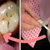 Vindeca afectiunile gingiilor, micile carii si albeste-ti dintii cu aceasta pasta naturala facuta in casa
